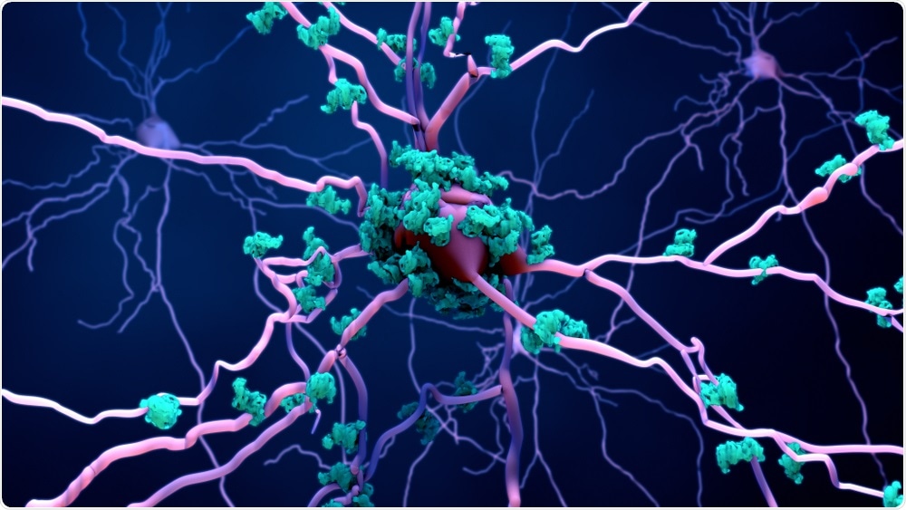 Antibodies attacking dying neuron