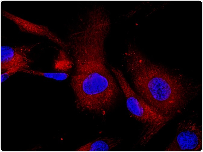 immunofluorescent array tomography