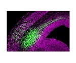 Scientists uncover new mechanisms regulating neural stem cells