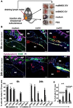 Skin-injected BMDC-EV attract immune cells. (A) Cartoon depicting the injection site of PKH26-labeled BMDC-EV, and images from excised skin patches and draining lymph nodes used for MELC analysis and marker quantification. For control, PKH26-containing medium and PBS were injected. (B) BMDC-derived EV attract immune cells in the skin. Tissue sections from skin patches described in (A) were subjected to a MELC analysis. Images represent an overlay of four markers (CD45, cytokeratin-14, PI, and EV). Cytokeratin-14 and CD45 were stained by antibodies, whereas EV (red stain) were visualized through PKH26. Tissue sections from two animals (6 h and 24 h) are presented. Using the StrataQuest software, the relative presence (in percentage) of common immune cell markers was quantified in EV-containing tissue areas. The relative presence by a bar diagram as indicated. Note: individual images for these markers are presented in Fig 5. Quantifications of MELC analyses from four different injection sites were used to determine the SEM. Scale bars represent 100 μm. (C) Monocytes and neutrophils in imDC-EV and maDC-EV areas. Monocytes (CD11b+/Ly6C+/Ly6G−) and neutrophils (CD45+/Ly6C+/Ly6G+) were quantified in the EV areas using the StrataQuest software as explained in Table 1 and Fig S8A. epi, epidermis; de, dermis; sc, subcutaneous.
