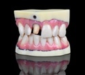 Stratasys' new J720 Dental 3D printer sets new standards for digital dentistry