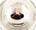 Researchers map an awake-brain