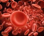 An Overview of the Protocol for Red Cell Lysis