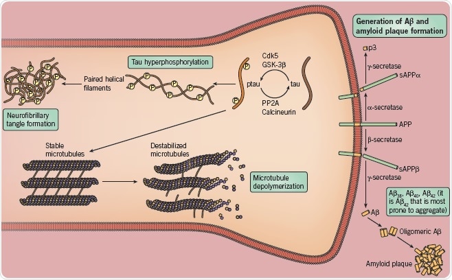Enzyme targets to be the focus of AD drug targets