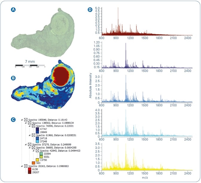 Spatial segmentation analysis of MALDI-MSI dataset from FFPE human thyroid tissue: (A) Optical image; (B) Segmentation map; (C) Segmentation tree; (D) Mean spectra of main regions extracted from segmentation result.