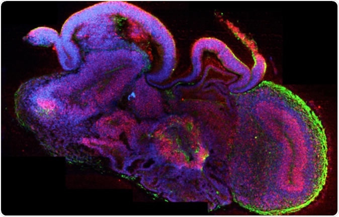 A section through a whole organoid stained for neurons in green and neural stem cells in red. All cell nuclei are stained in blue.