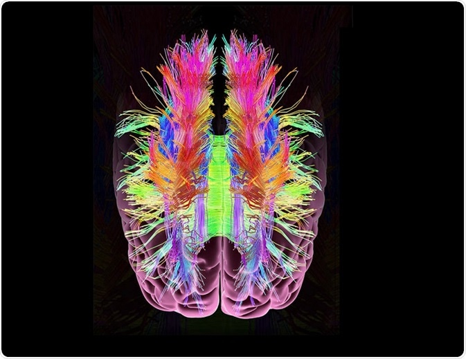 CLARITY is a popular method of removing lipids from brain tissue in order to see other structures such as neurons