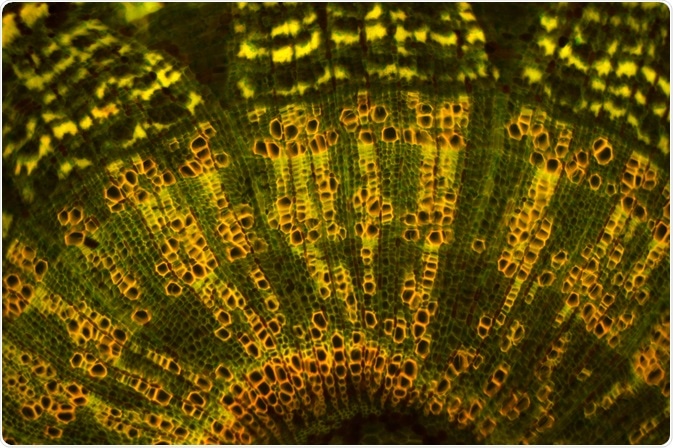 Reflection-contrast microscopy is said to bridge the gap between light microscopy and electron microscopy