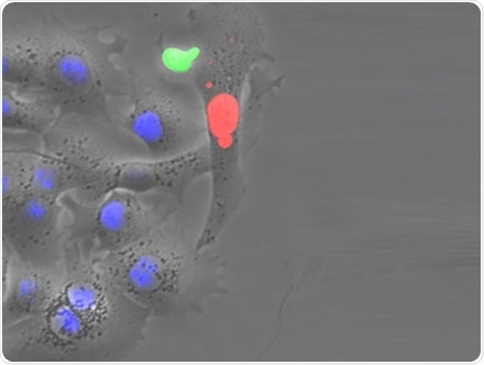 Researchers succeed in conquering chronic infection with hepatitis B virus