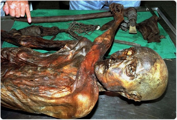 Ötzi had a total of 61 tattoos consisting of 19 groups of black lines ranging from 1 to 3 mm in thickness and 7 to 40 mm long.