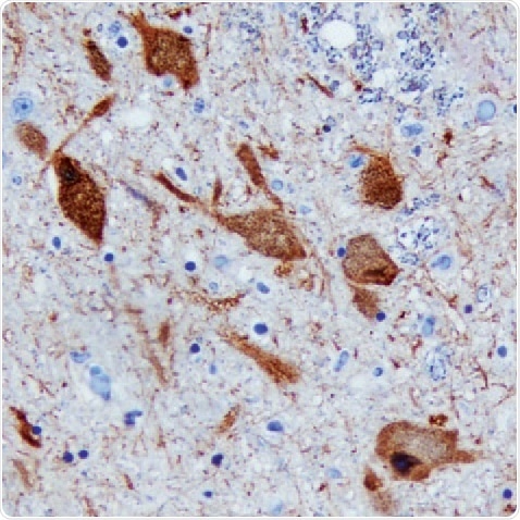 DDC in Human Brain.