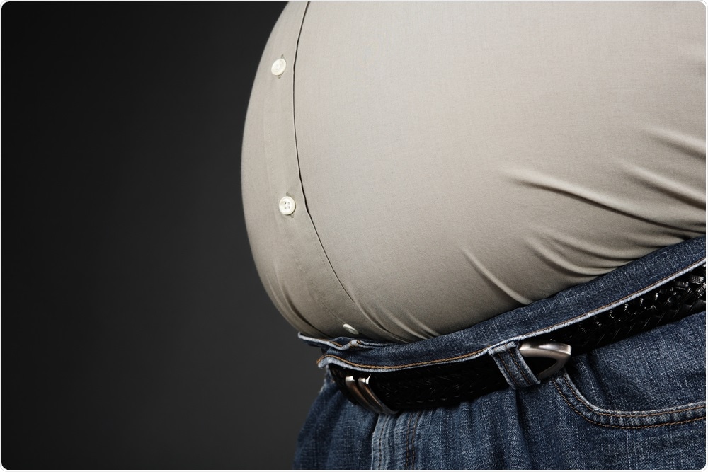 Obesity is a huge health issue in the USA.