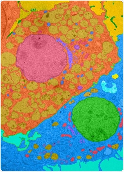 Disruption of immune cell behavior may spur heart disease, heart failure