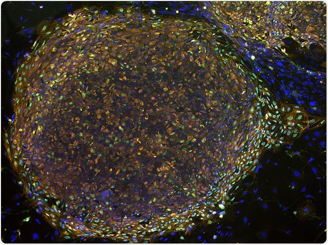 Colony of stem cells