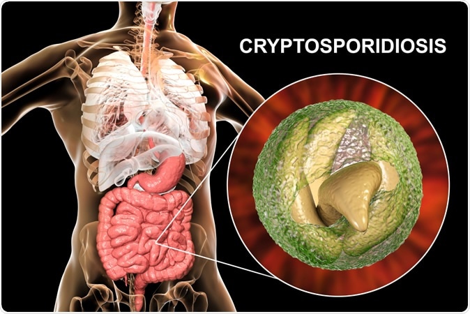 Cryptosporidiosis, a diarrheal disease caused by Cryptosporidium parvum protozoan. 3D illustration showing release of parasite sporozoites from oocyst inside small intestine - Illustration Credit: Kateryna Kon / Shutterstock