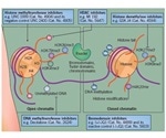 Epigenetic Drug Targets of Rheumatoid Arthritis