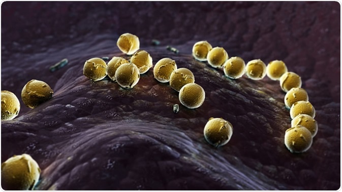 Streptococcus pyogenes infection. Image Credit: Dragos Pop / Shutterstock