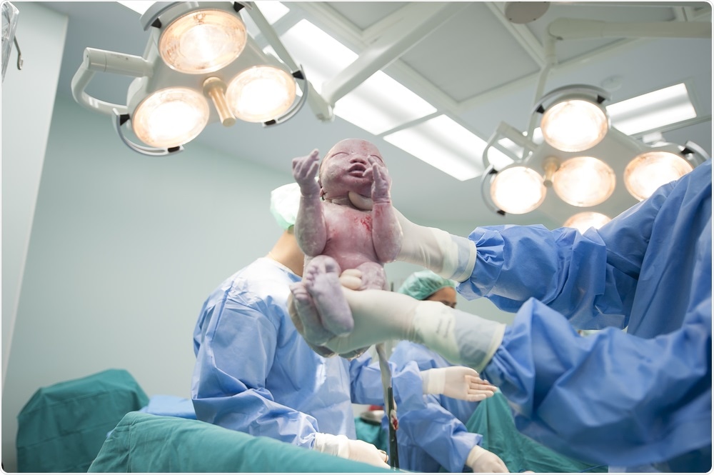 Newborn baby in the operating room