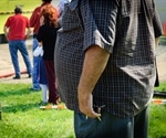 Obesity Drug Inhibits Prostate Tumor Growth