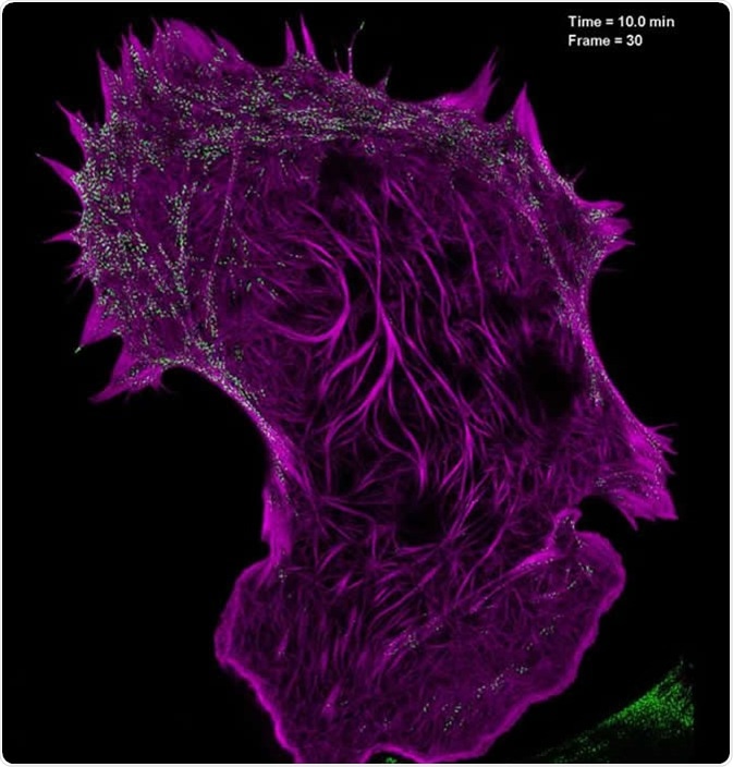 Still image from a video showing the interaction of filamentous actin (mApple-F-tractin, purple) with myosin IIA bipolar head groups (EGFP, myosin IIA, green) at 20-second intervals for 100 time points, as seen with high-NA TIRF-SIM. Image Credit: Betzig Lab, HHMI/Janelia Research Campus