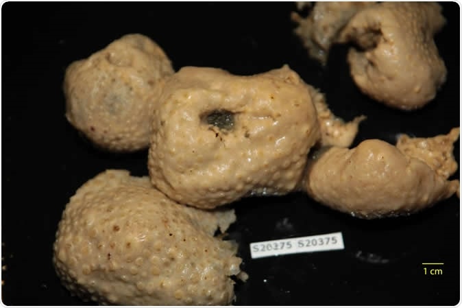 Antarctic sea sponge extracts provide leads for new malaria treatments. Image Credit: Bill Baker