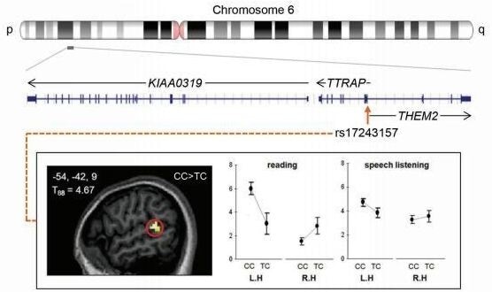 Scientists unable to replicate influential neuroimaging genetics study