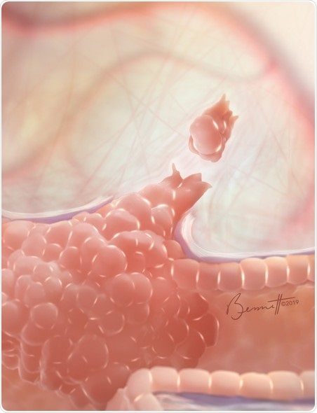 Cell adhesion protein promotes metastasis in breast cancer, study reveals