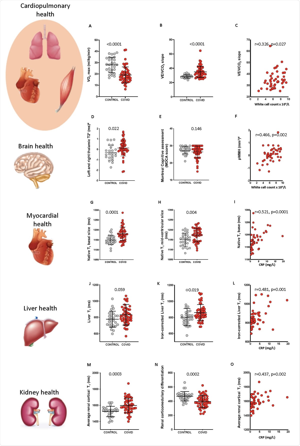 Systemic effects of COVID-19 and relationship with inflammatory response