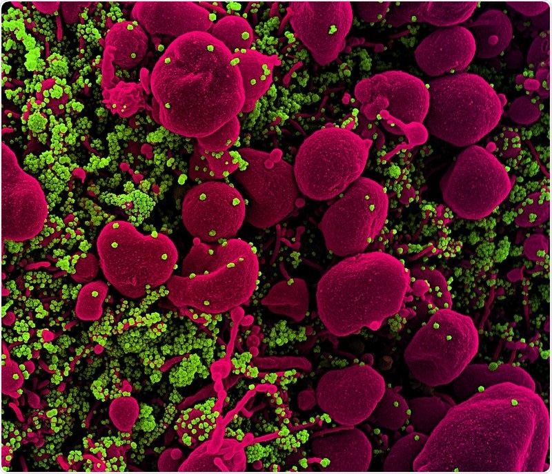 Study: Changes of Humoral Immunity Response in SARS-CoV-2 Convalescent Patients over 8 months. Image Credit NIAID / Flickr