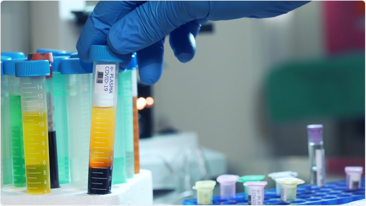 Study: Production of anti-SARS-CoV-2 hyperimmune globulin from convalescent plasma. Image Credit: JHDT Productions / Shutterstock