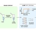 Rapid no-frills detection of SARS-CoV-2 in saliva with LAMP-Cas13