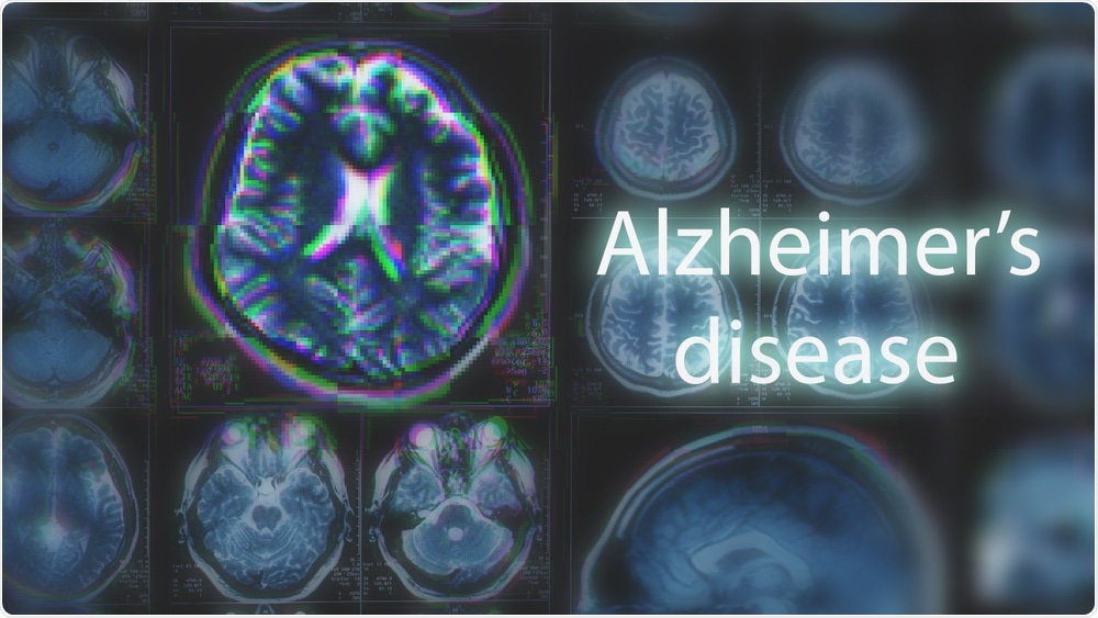 Alzheimers Disease