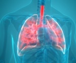 Preventing Ventilator-Associated Pneumonia with NMR
