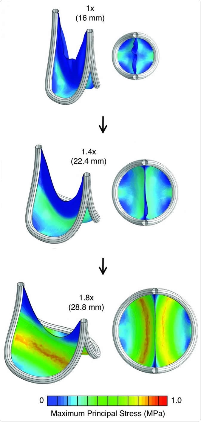 The scientists used computational modeling to predict how their valve replacement expanded to deal with the stress of blood flow. This material relates to a paper that appeared in the Feb. 19, 2020, issue of Science Translational Medicine, published by AAAS. The paper, by S.C. Hofferberth at Boston Children