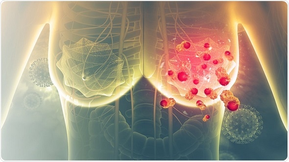 New 3D model shows how breast cancer cells interact with the body’s stem cells