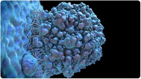 Combination therapy for pediatric low-grade gliomas shows promise in mice