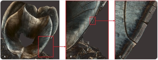 Panel A is a longitudinal section of the maxillary second molar of a 35-year-old female who had children at ages 19 and 24. Panel B is a zoomed-in section of Panel A. Panel C reveals, at left, the dentine, covered, at right, by the cementum, which presents two distinct darker