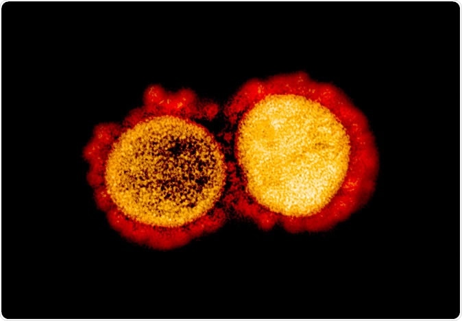 Novel Coronavirus SARS-CoV-2 Transmission electron micrograph of SARS-CoV-2 virus particles, isolated from a patient. Image captured and color-enhanced at the NIAID Integrated Research Facility (IRF) in Fort Detrick, Maryland. Credit: NIAID