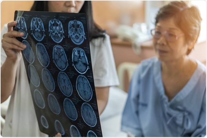 Association of Stress-Related Disorders With Subsequent Neurodegenerative Diseases. Image Credit: Chinnapong / Shutterstock