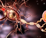 Experimental drug targets early toxic amyloid to slow Alzheimer’s disease