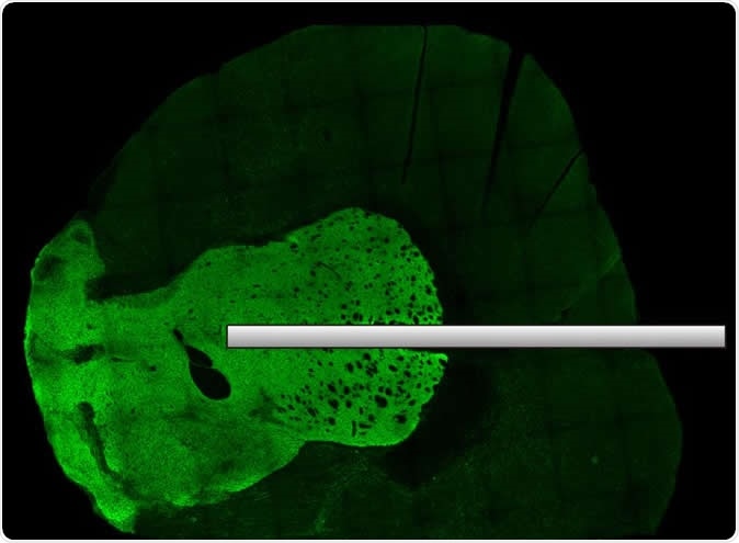 Activity in neuronal tissue can be optically recorded with fiber optics. Image: © 2020 Yagishita et al.
