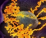 Researchers identify enzymes that activate coronavirus for infection