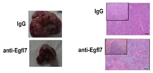 A promising strategy to overcome drug resistance developed by blood cancer cells