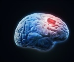Engineers innovate soft, flexible brain implant