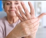 Living with Rheumatoid Arthritis