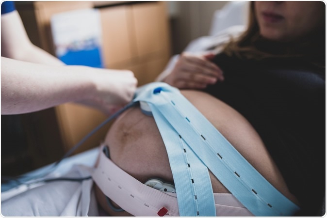 Facing a Pandemic While Pregnant. Doctor performing an ultrasound scan. Image Credit: Shutterstock
