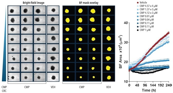 Quantification Spheroid Growth and Shrinkage. Effect of CMP on growth of A549 cells in a spheroid assay. A549 cells were plated at a density of 5,000 cells per well and spheroid allowed to form (72-hours). Serial dilutions of CMP were then added to the cells and the kinetics of spheroid growth and shrinkage were measured. Images represent the BF view and segmentation at