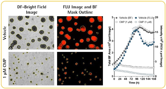 Multi-Spheroid 3D Tumor Assays Development for Live-Cell Analysis