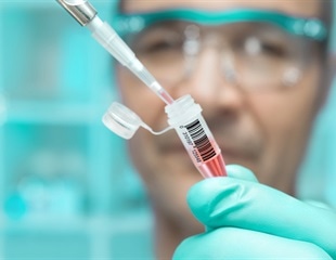 Remdesivir shows promise in post-infection treatment for COVID-19 disease