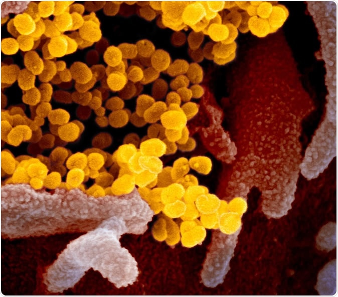 Novel Coronavirus SARS-CoV-2 This scanning electron microscope image shows SARS-CoV-2 (yellow)—also known as 2019-nCoV, the virus that causes COVID-19—isolated from a patient in the U.S., emerging from the surface of cells (pink) cultured in the lab. Image captured and colorized at NIAID